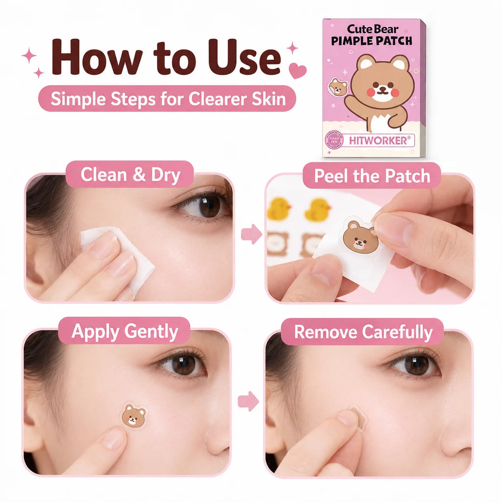 Cute Cartoon Hydrocolloid Blemish Patches – 72 Pack